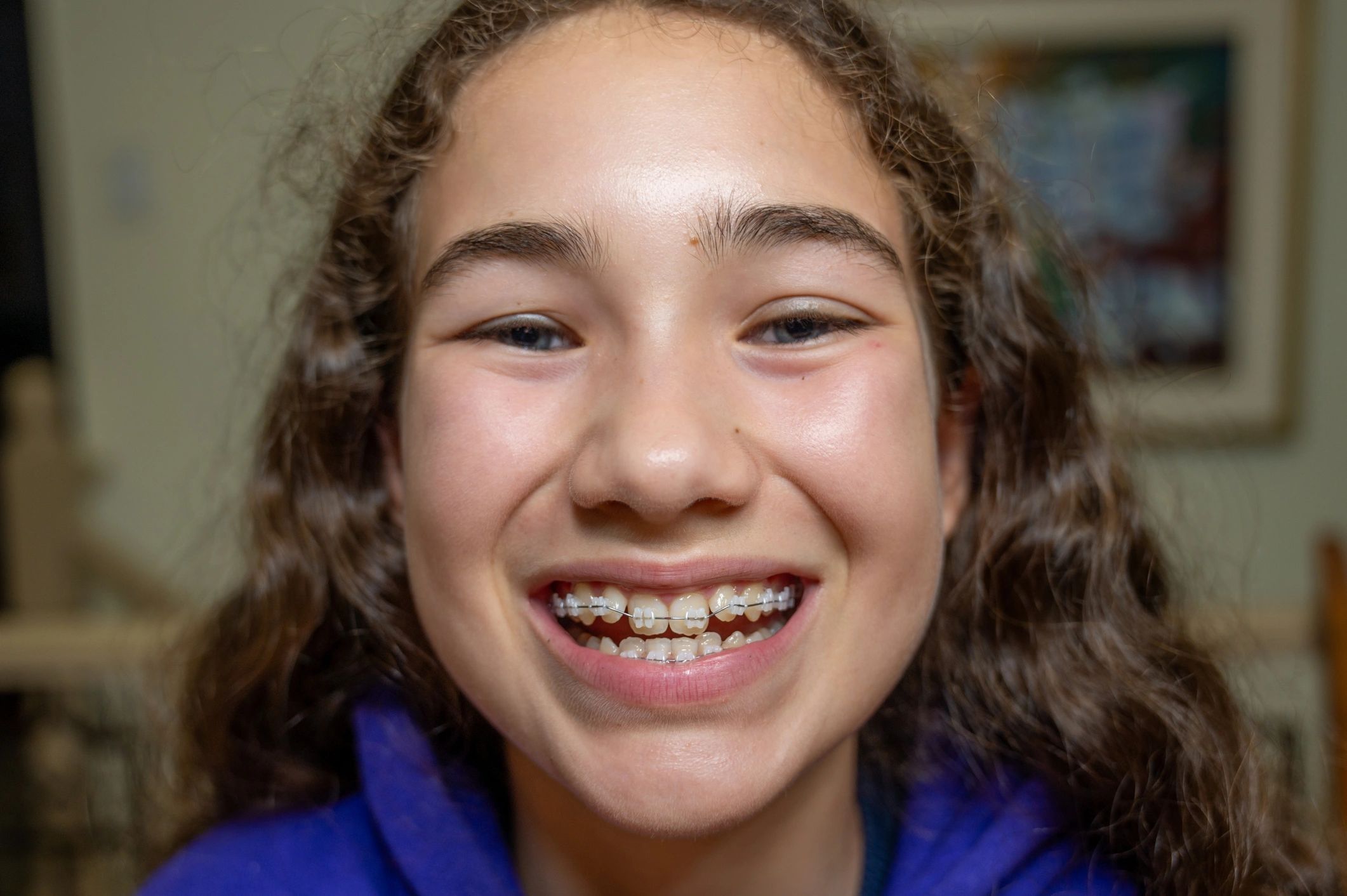 Teen girl smiling with braces close up